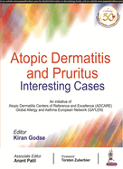 Atopic Dermatitis and Pruritus: Interesting Cases