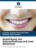 Auswirkung von Zahnaufhellung und zwei Adh?siven