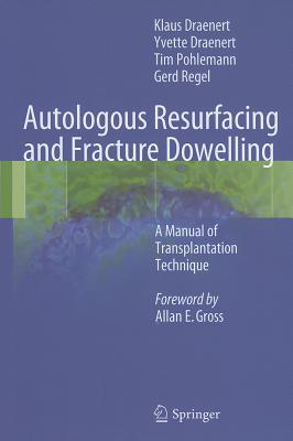 Autologous Resurfacing and Fracture Dowelling: A Manual of Transplantation Technique - Draenert, Klaus, and Draenert, Yvette, and Pohlemann, Tim