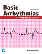 Basic Arrhythmias with 12-Lead EKGs