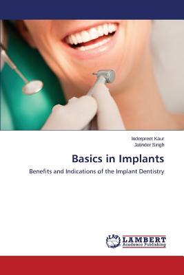 Basics in Implants - Kaur Inderpreet, and Singh Jatinder