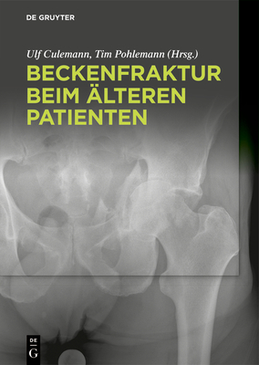 Beckenfraktur beim ?lteren Patienten - Culemann, Ulf (Editor), and Pohlemann, Tim (Editor)