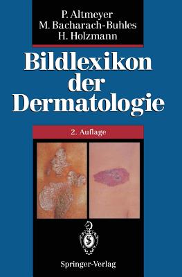 Bildlexikon Der Dermatologie - Buhles, N, and Altmeyer, Peter, and Bacharach-Buhles, Martina