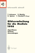 Bildverarbeitung Fr Die Medizin 1998: Algorithmen -- Systeme -- Anwendungen Proceedings Des Workshops Am 26. Und 27. Mrz 1998 in Aachen