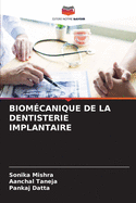 Biom?canique de la Dentisterie Implantaire