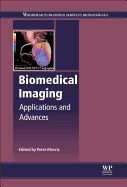 Biomedical Imaging: Applications and Advances