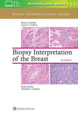 Biopsy Interpretation of the Breast - Schnitt, Stuart J., and Collins, Laura C.