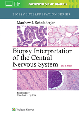 Biopsy Interpretation of the Central Nervous System - Schniederjan, Matthew J.
