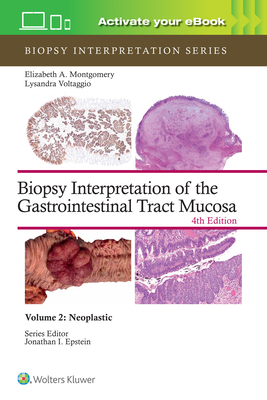 Biopsy Interpretation of the Gastrointestinal Tract Mucosa Volume 2: Neoplastic: Print + eBook with Multimedia - MONTGOMERY, ELIZABETH ANNE, and VOLTAGGIO, LYSANDRA