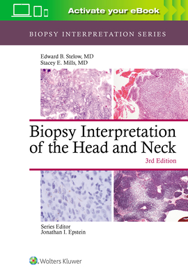 Biopsy Interpretation of the Head and Neck - Stelow, Edward B, MD, and Mills, Stacey