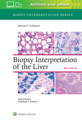 Biopsy Interpretation of the Liver - Torbenson, Michael, MD