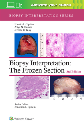 Biopsy Interpretation: The Frozen Section: Print + eBook with Multimedia - Cipriani, Nicole A, MD, and Husain, Aliya N, MD, and Taxy, Jerome B, MD
