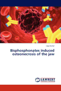 Bisphosphonates Induced Osteonecrosis of the Jaw