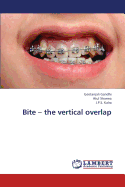Bite - The Vertical Overlap