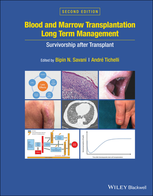 Blood and Marrow Transplantation Long Term Management: Survivorship After Transplant - Savani, Bipin N (Editor), and Tichelli, Andre (Editor)