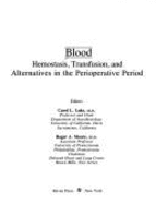 Blood: Hemostasis, Transfusion, and Alternatives in the Perioperative Period