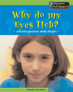 Body Matters Why do my eyes itch Paperback