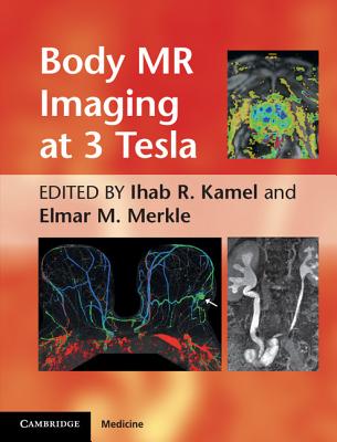 Body MR Imaging at 3 Tesla - Kamel, Ihab R. (Editor), and Merkle, Elmar M. (Editor)