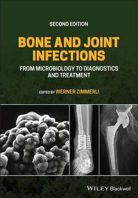 Bone and Joint Infections: From Microbiology to Diagnostics and Treatment - Zimmerli, Werner (Editor)