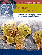 Bone Cancer: Current and Emerging Trends in Detection and Treatment