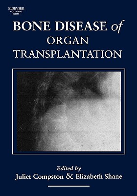 Bone Disease of Organ Transplantation - Compston, Juliet (Editor), and Shane, Elizabeth (Editor)