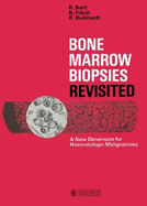 Bone Marrow Biopsies Revisited: A New Dimension for Hematologic Malignancies