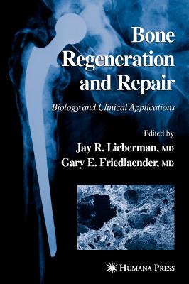 Bone Regeneration and Repair: Biology and Clinical Applications - Lieberman, Jay R (Editor), and Friedlaender, Gary E, MD (Editor)