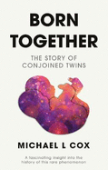 Born Together: The Story of Conjoined Twins
