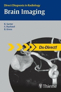 Brain Imaging: Direct Diagnosis in Radiology