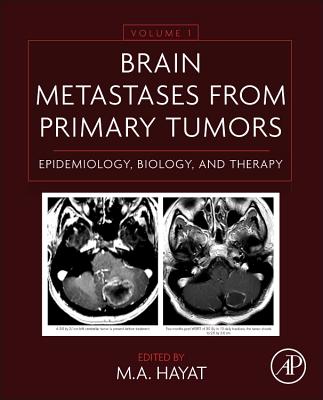 Brain Metastases from Primary Tumors Volume 1: Epidemiology, Biology, and Therapy - Hayat, M A (Editor)