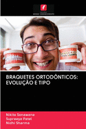 Braquetes Ortod?nticos: Evolu??o E Tipo