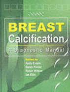 Breast Calcification: A Diagnostic Manual