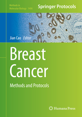 Breast Cancer: Methods and Protocols - Cao, Jian (Editor)