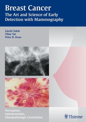 Breast Cancer: The Art and Science of Early Detection with Mammography - Tabar, Laszlo, and Tot, Tibor, and Dean, Peter B.