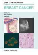 Breast Cancer: Visual Guide for Clinicians