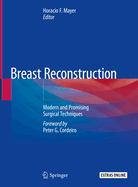 Breast Reconstruction: Modern and Promising Surgical Techniques
