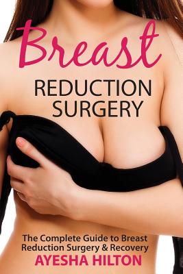 Breast Reduction Surgery: The Complete Guide to Breast Reduction Surgery & Recovery - Hilton, Ayesha