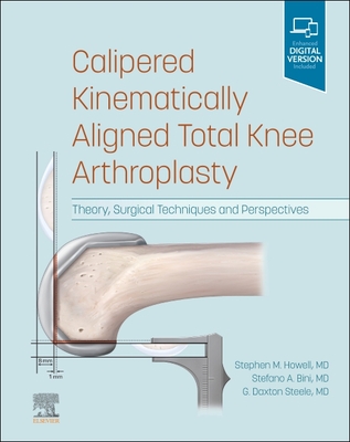 Calipered Kinematically aligned Total Knee Arthroplasty: Theory, Surgical Techniques and Perspectives - Howell, Stephen M., and Bini, Stefano A., MD, and Steele, G. Daxton, MD