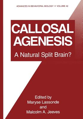 Callosal Agenesis: A Natural Split Brain? - Lassone, Maryse (Editor), and Jeeves, Malcolm A (Editor)