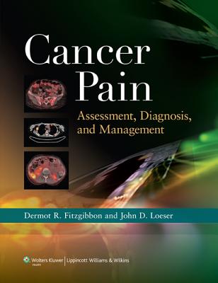 Cancer Pain: Assessment, Diagnosis, and Management - Fitzgibbon, Dermot R, and Loeser, John D