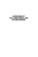 Carcinoma of the Large Bowel and Its Precursors: Proceedings of a Conference on Held in Detroit, September 27-28, 1984