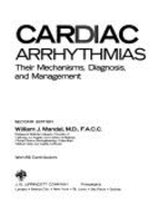 Cardiac Arrhythmias: Their Mechanisms, Diagnosis, and Management - Mandel, William J
