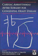 Cardiac Arrythmias After Surgery for Congenital Heart Disease