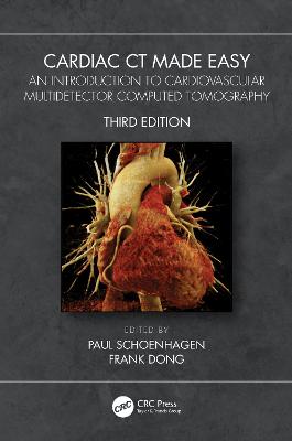 Cardiac CT Made Easy: An Introduction to Cardiovascular Multidetector Computed Tomography - Schoenhagen, Paul (Editor), and Dong, Frank (Editor)