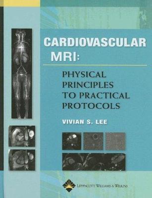 Cardiovascular MRI: Physical Principles to Practical Protocols - Lee, Vivian S, MD, PhD