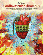 Cardiovascular Thrombus: From Pathology and Clinical Presentations to Imaging, Pharmacotherapy and Interventions