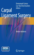 Carpal Ligament Surgery: Before Arthritis