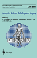 Cars 2002 Computer Assisted Radiology and Surgery: Proceedings of the 16th International Congress and Exhibition Paris, June 26-29,2002