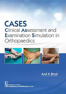 Cases: Clinical Assessment and Examination Simulation in Orthopaedics - Bhat, Anil