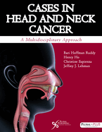 Cases in Head and Neck Cancer: A Multidisciplinary Approach